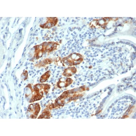 Immunohistochemistry - Anti-RRM1 Antibody [RRM1/4372R] (A278059) - Antibodies.com