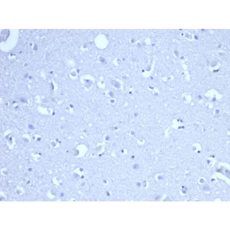 Immunohistochemistry - Anti-RRM1 Antibody [RRM1/4372R] (A278059) - Antibodies.com