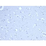 Immunohistochemistry - Anti-RRM1 Antibody [RRM1/4372R] (A278059) - Antibodies.com