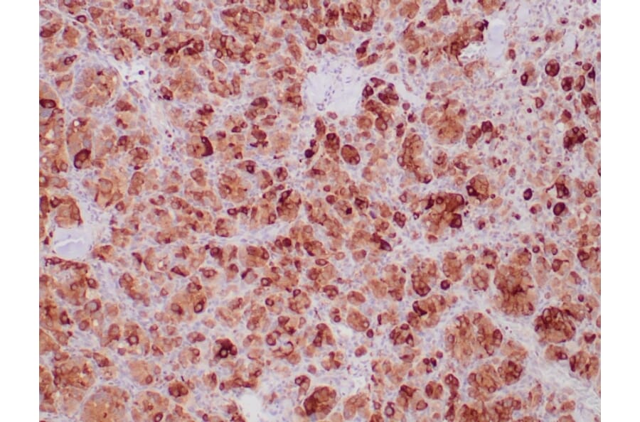 Immunohistochemistry - Anti-SDHB Antibody [SDHB/6697R] (A278060) - Antibodies.com