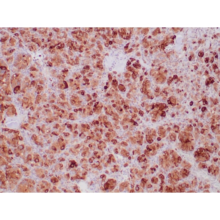 Immunohistochemistry - Anti-SDHB Antibody [SDHB/6697R] (A278060) - Antibodies.com