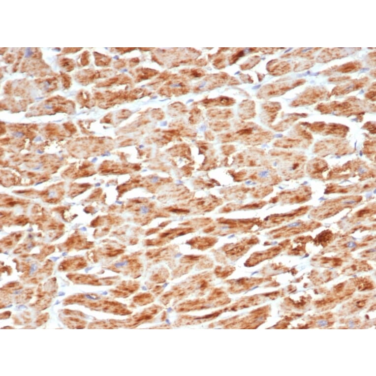 Immunohistochemistry - Anti-SDHB Antibody [SDHB/6697R] (A278060) - Antibodies.com