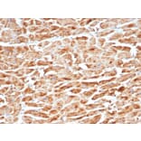 Immunohistochemistry - Anti-SDHB Antibody [SDHB/6697R] (A278060) - Antibodies.com