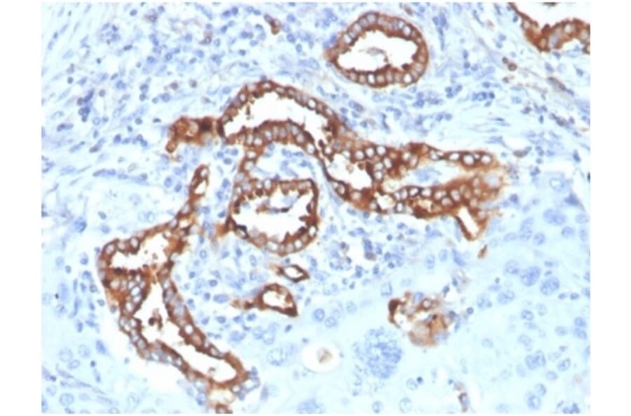 Immunohistochemistry - Anti-Surfactant Protein D Antibody [SFTPD/7084R] (A278061) - Antibodies.com
