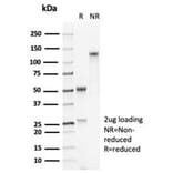 SDS-PAGE - Anti-Surfactant Protein D Antibody [SFTPD/7084R] (A278061) - Antibodies.com