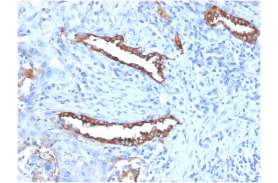 Immunohistochemistry - Anti-Surfactant Protein D Antibody [SFTPD/7085R] (A278062) - Antibodies.com