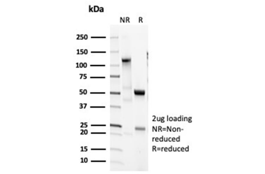 SDS-PAGE - Anti-Surfactant Protein D Antibody [SFTPD/7085R] (A278062) - Antibodies.com