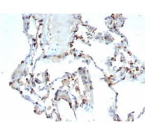 Immunohistochemistry - Anti-Surfactant Protein D Antibody [SFTPD/7086R] (A278063) - Antibodies.com