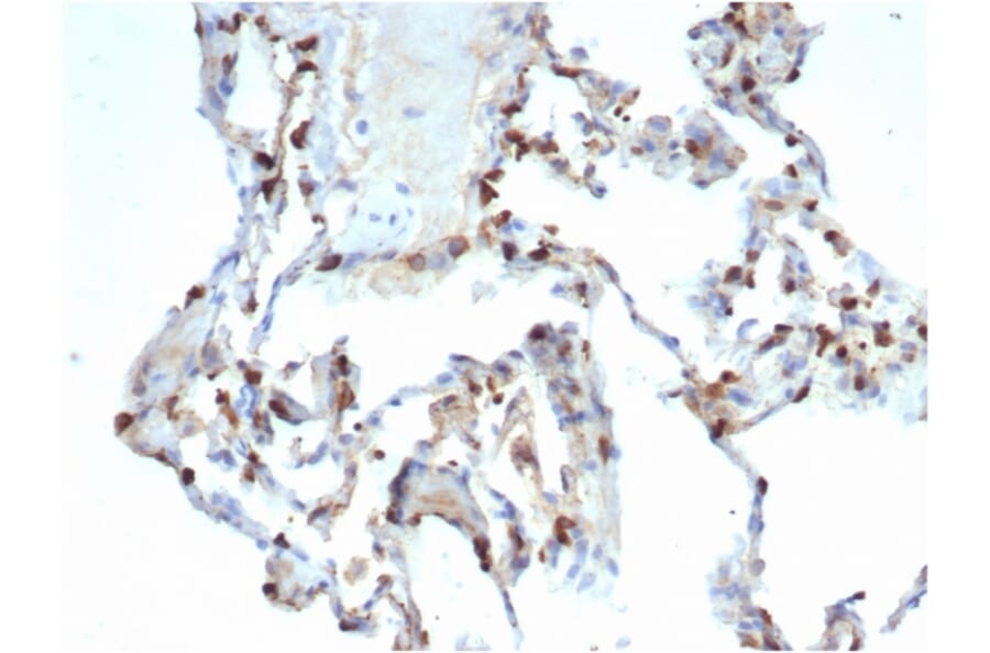 Immunohistochemistry - Anti-Surfactant Protein D Antibody [SFTPD/7086R] (A278063) - Antibodies.com