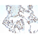 Immunohistochemistry - Anti-Surfactant Protein D Antibody [SFTPD/7086R] (A278063) - Antibodies.com