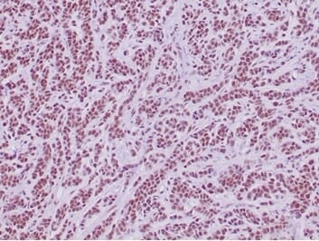 Anti-INI 1 Antibody [ABT-INI1] (A98879) | Antibodies.com