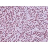 Immunohistochemistry - Anti-SNF5 Antibody [SMARCB1/4587R] (A278064) - Antibodies.com