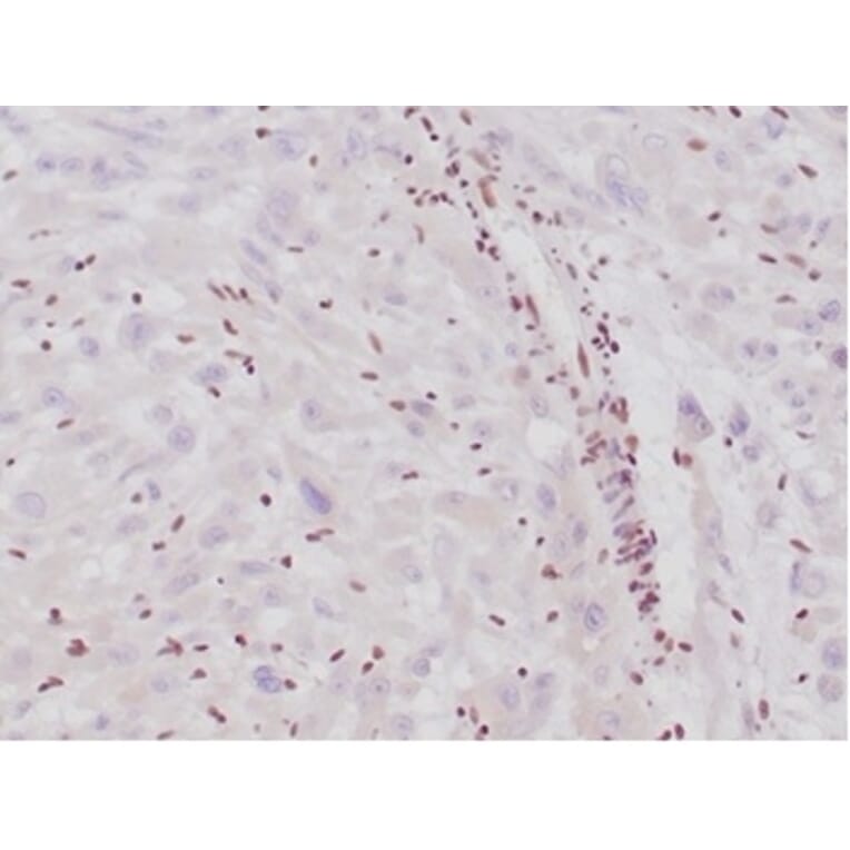 Immunohistochemistry - Anti-SNF5 Antibody [SMARCB1/4587R] (A278064) - Antibodies.com