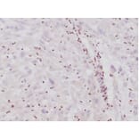 Immunohistochemistry - Anti-SNF5 Antibody [SMARCB1/4587R] (A278064) - Antibodies.com