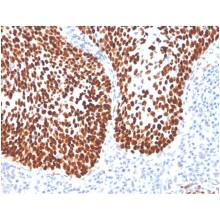 Immunohistochemistry - Anti-SOX2 Antibody [SOX2/4267R] (A278065) - Antibodies.com