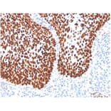 Immunohistochemistry - Anti-SOX2 Antibody [SOX2/4267R] (A278065) - Antibodies.com