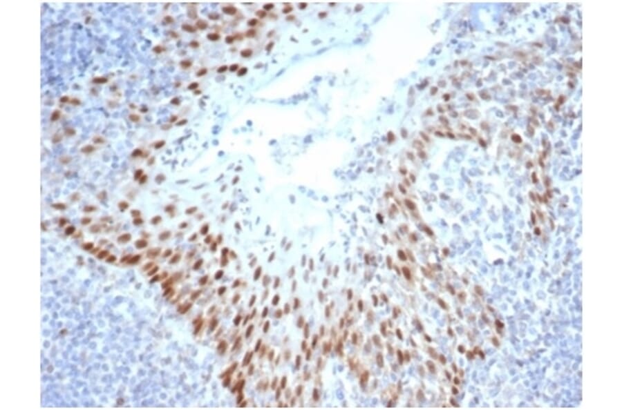 Immunohistochemistry - Anti-SOX2 Antibody [SOX2/4267R] (A278065) - Antibodies.com