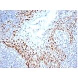 Immunohistochemistry - Anti-SOX2 Antibody [SOX2/4267R] (A278065) - Antibodies.com
