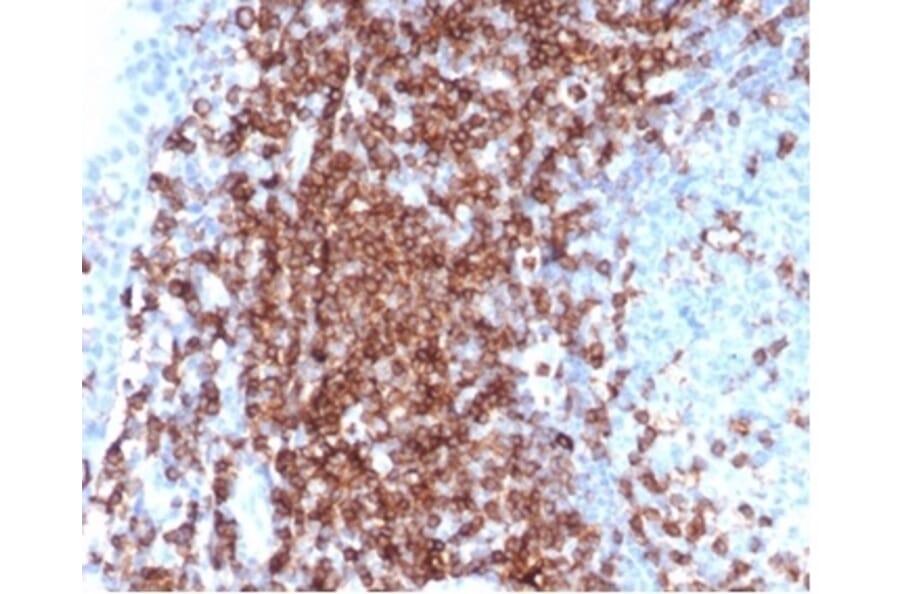 Immunohistochemistry - Anti-CD43 Antibody [SPN/6562R] (A278066) - Antibodies.com