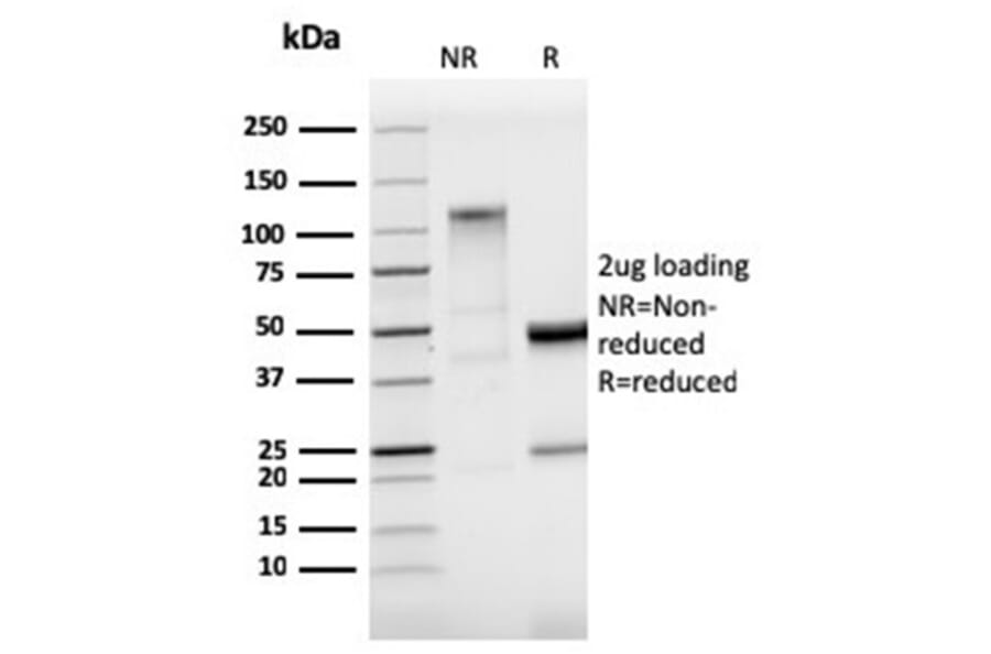 SDS-PAGE - Anti-StAR Antibody [STAR/3915R] (A278067) - Antibodies.com