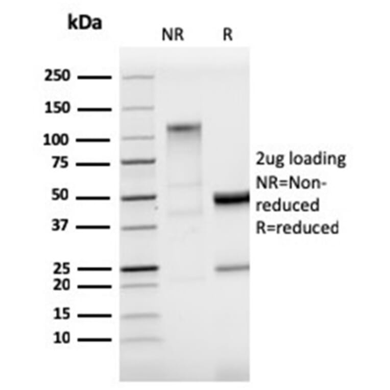 SDS-PAGE - Anti-StAR Antibody [STAR/3915R] (A278067) - Antibodies.com