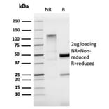 SDS-PAGE - Anti-StAR Antibody [STAR/3915R] (A278067) - Antibodies.com