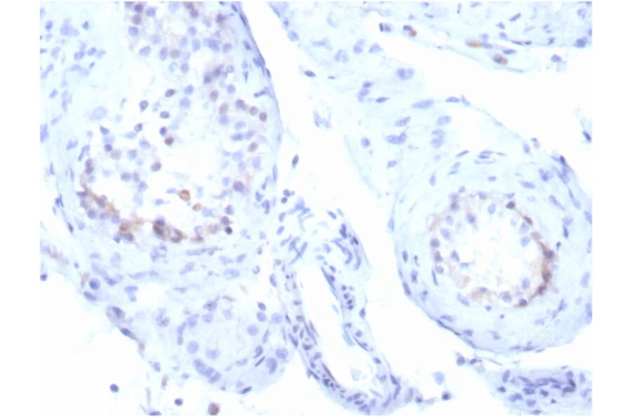Immunohistochemistry - Anti-StAR Antibody [STAR/3915R] (A278067) - Antibodies.com