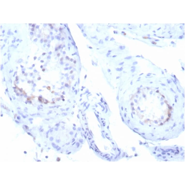 Immunohistochemistry - Anti-StAR Antibody [STAR/3915R] (A278067) - Antibodies.com