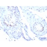 Immunohistochemistry - Anti-StAR Antibody [STAR/3915R] (A278067) - Antibodies.com