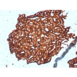 Immunohistochemistry - Anti-Synaptophysin Antibody [SYP/4389R] (A278069) - Antibodies.com