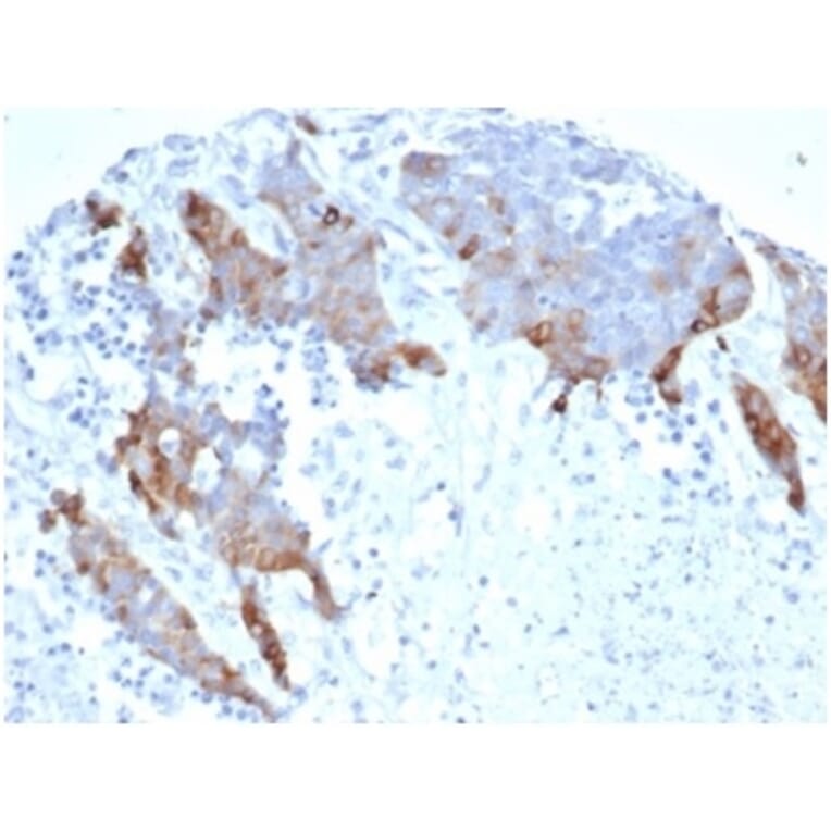 Immunohistochemistry - Anti-Transglutaminase II Antibody [TGM2/6943R] (A278070) - Antibodies.com