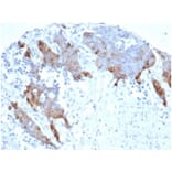 Immunohistochemistry - Anti-Transglutaminase II Antibody [TGM2/6943R] (A278070) - Antibodies.com