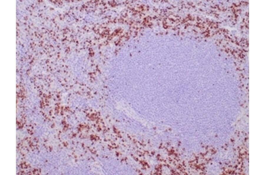 Immunohistochemistry - Anti-TIA1 Antibody [TIA1/1352R] (A278071) - Antibodies.com