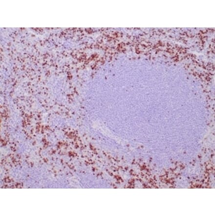 Immunohistochemistry - Anti-TIA1 Antibody [TIA1/1352R] (A278071) - Antibodies.com