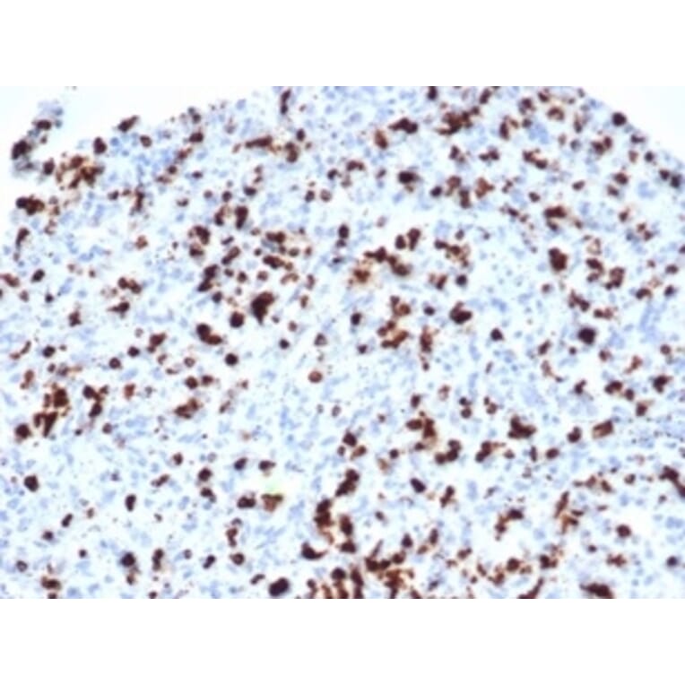 Immunohistochemistry - Anti-TIA1 Antibody [TIA1/1352R] (A278071) - Antibodies.com
