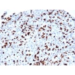 Immunohistochemistry - Anti-TIA1 Antibody [TIA1/1352R] (A278071) - Antibodies.com