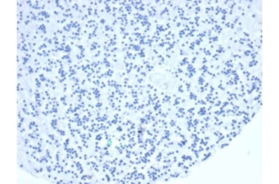 Immunohistochemistry - Anti-TIA1 Antibody [TIA1/1352R] (A278071) - Antibodies.com