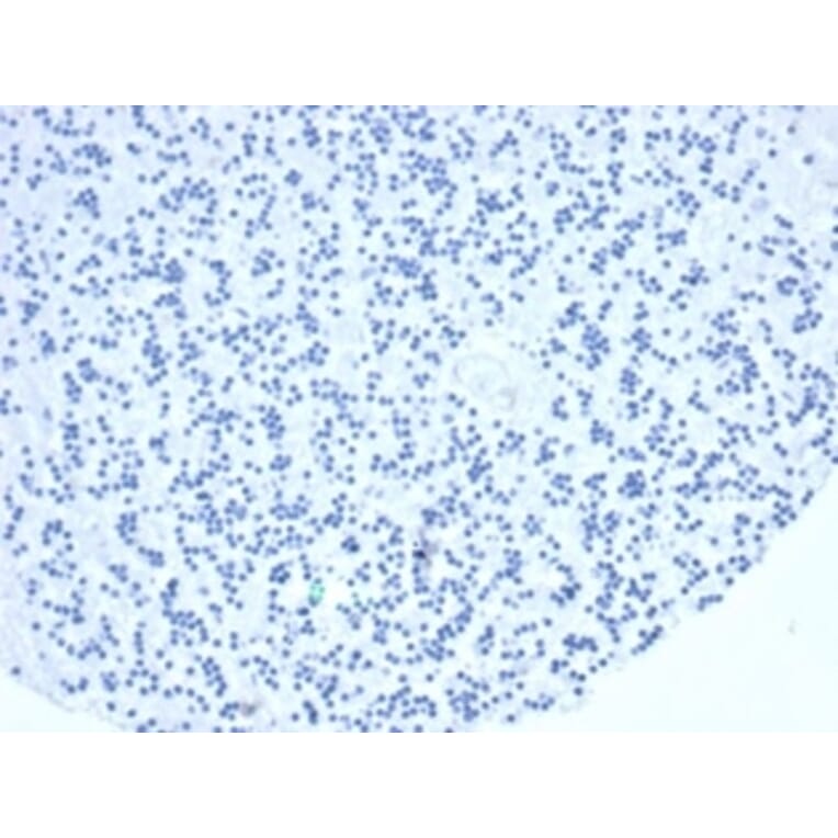 Immunohistochemistry - Anti-TIA1 Antibody [TIA1/1352R] (A278071) - Antibodies.com