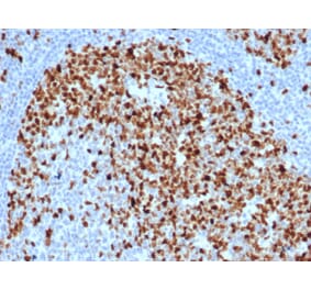 Immunohistochemistry - Anti-Topoisomerase II alpha Antibody [TOP2A/6570R] (A278072) - Antibodies.com