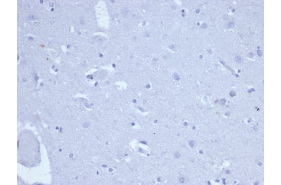 Immunohistochemistry - Anti-Topoisomerase II alpha Antibody [TOP2A/6570R] (A278072) - Antibodies.com