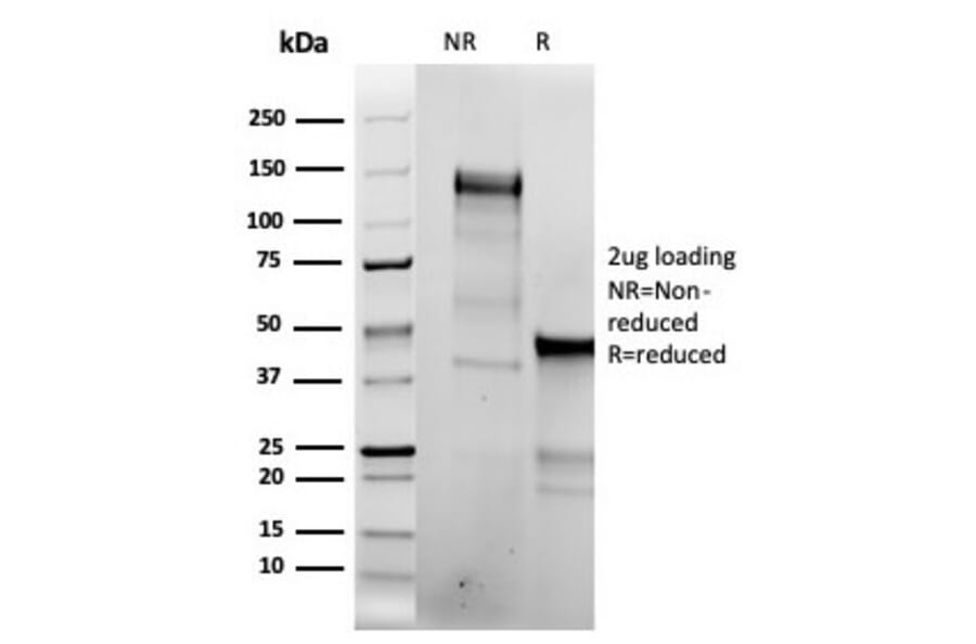 SDS-PAGE - Anti-Topoisomerase II alpha Antibody [TOP2A/6570R] (A278072) - Antibodies.com