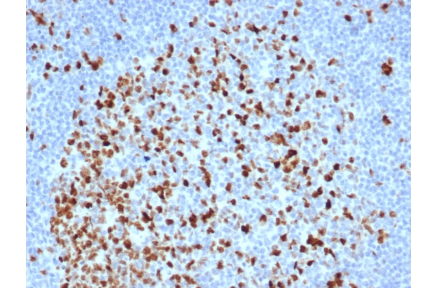 Immunohistochemistry - Anti-Topoisomerase II alpha Antibody [TOP2A/6570R] (A278072) - Antibodies.com