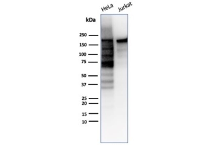 Western Blot - Anti-Topoisomerase II alpha Antibody [TOP2A/6570R] (A278072) - Antibodies.com