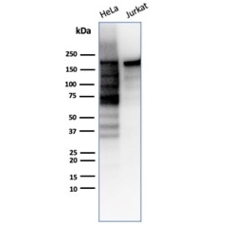Western Blot - Anti-Topoisomerase II alpha Antibody [TOP2A/6570R] (A278072) - Antibodies.com
