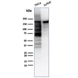 Western Blot - Anti-Topoisomerase II alpha Antibody [TOP2A/6570R] (A278072) - Antibodies.com