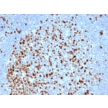 Immunohistochemistry - Anti-Topoisomerase II alpha Antibody [TOP2A/6570R] (A278072) - Antibodies.com