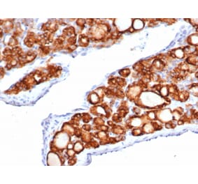 Immunohistochemistry - Anti-Thyroid Peroxidase Antibody [TPO/6417R] (A278074) - Antibodies.com