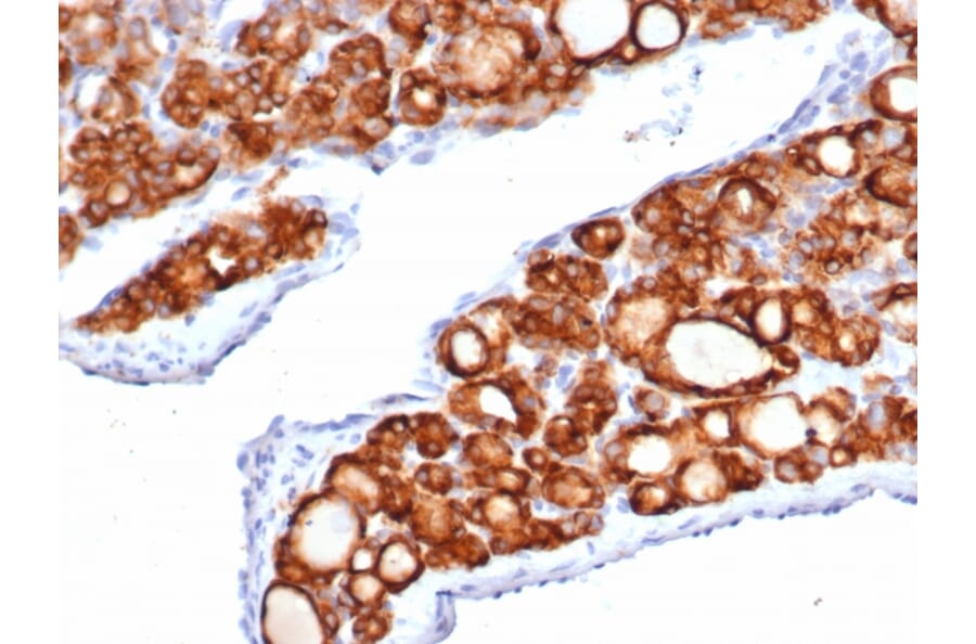 Immunohistochemistry - Anti-Thyroid Peroxidase Antibody [TPO/6417R] (A278074) - Antibodies.com