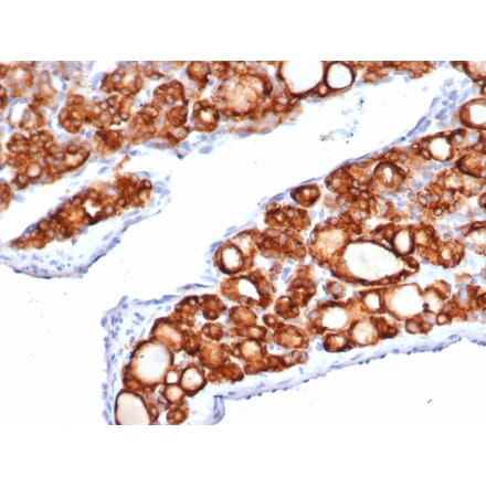 Immunohistochemistry - Anti-Thyroid Peroxidase Antibody [TPO/6417R] (A278074) - Antibodies.com