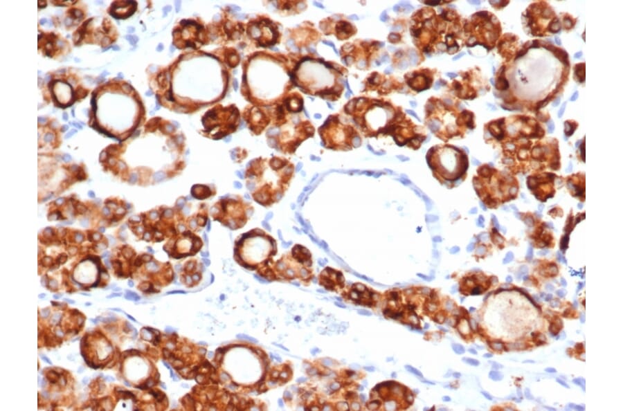 Immunohistochemistry - Anti-Thyroid Peroxidase Antibody [TPO/6417R] (A278074) - Antibodies.com